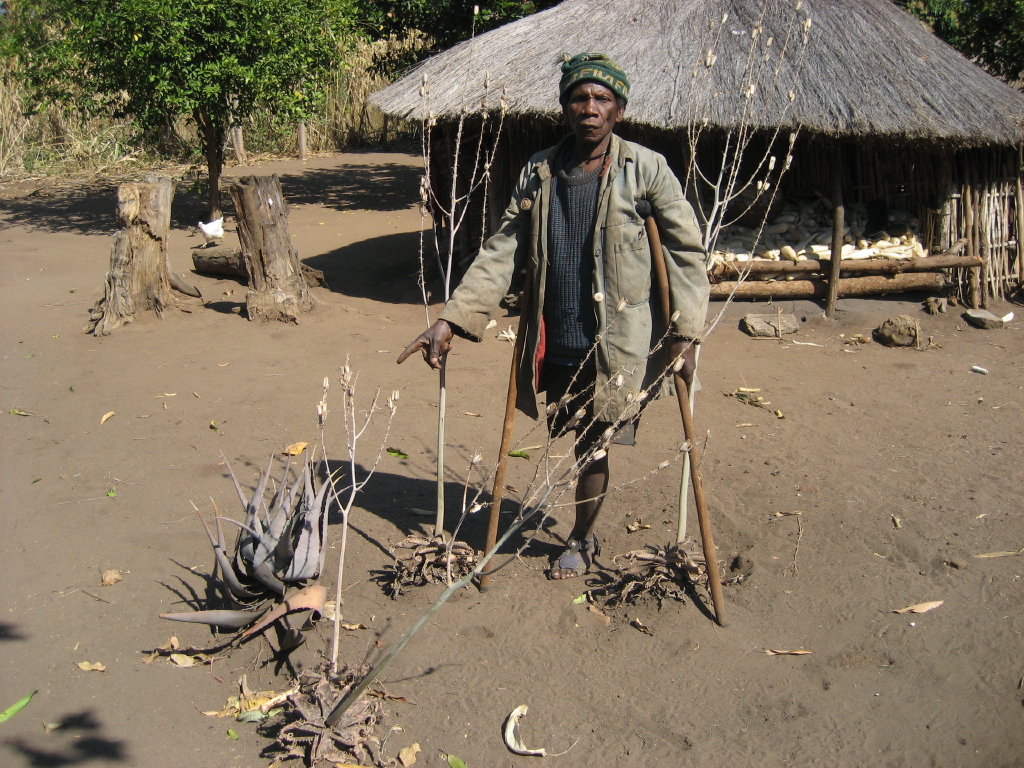 Seorang korban ranjau darat di Mozambik, salah satu dampak mengerikan dari perang saudara yang berkepanjangan.